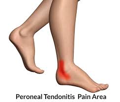 turmeric for tendonitis 3